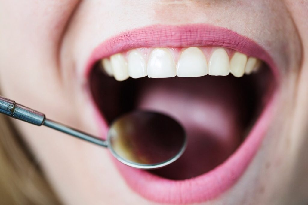 Dental Fillings in Phoenix, AZ