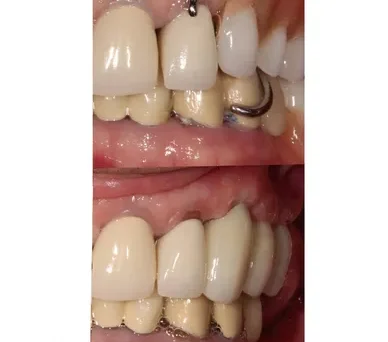 The successful results of effective Dental treatment
