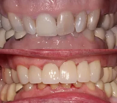 Transformative results following dental treatment
