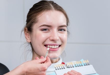 How Dental Veneers Preserve Your Natural Teeth