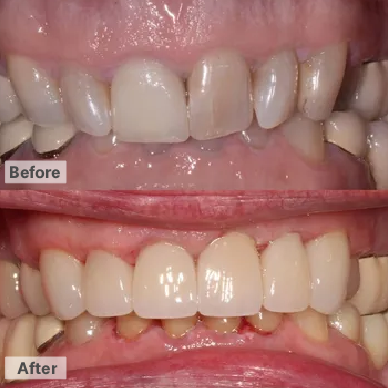 Dental in Phoenix , Before After