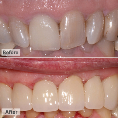 Dental in Phoenix , Before After