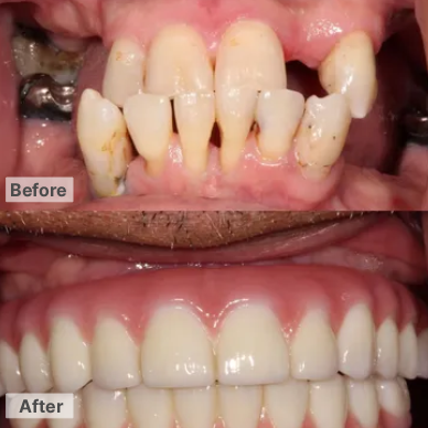 Dental in Phoenix , Before After