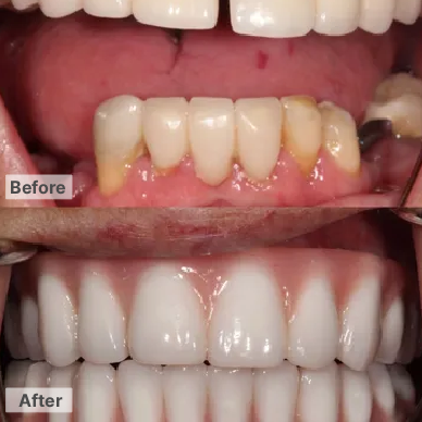 Dental in Phoenix , Before After