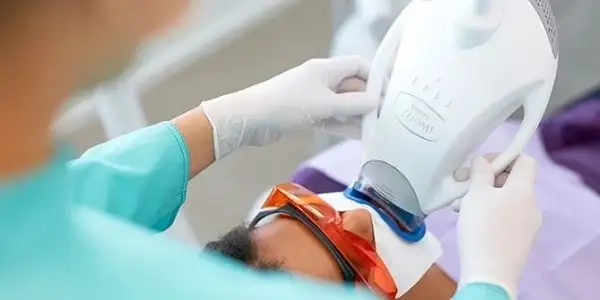 Benefits of Professional Teeth Whitening
