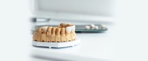 Comparing Types of Veneers Why Choose Ceramic