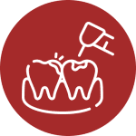 Dental Fillings