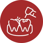 Dental Fillings