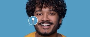 How Proper Jaw Alignment with Dental Implants Can Benefit Your Ear Health