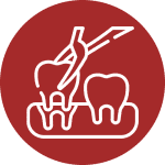 Tooth Extraction
