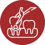 Tooth Extraction