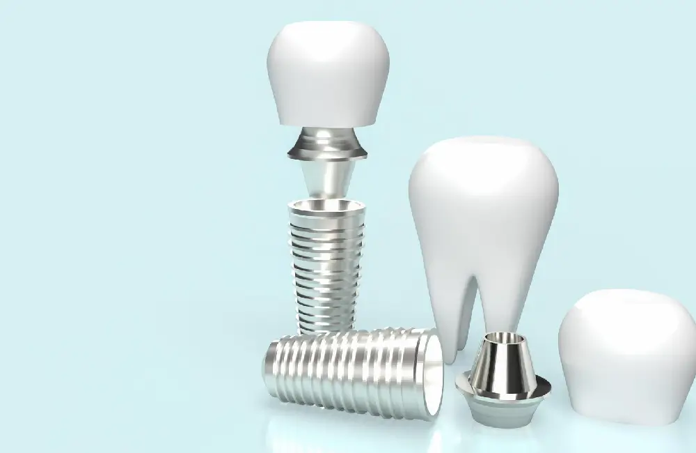 Benefit of Ceramic Dental Implants in Phoenix, AZ