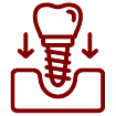 Tooth Implant
