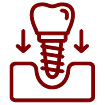 Tooth Implant