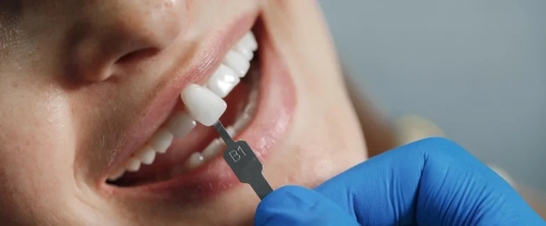 Top 5 Benefits of Dental Implants in Phoenix, AZ