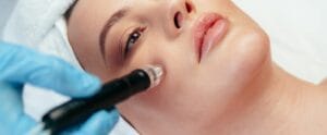 How Much Does Anti-Aging Microneedling Cost in Phoenix?