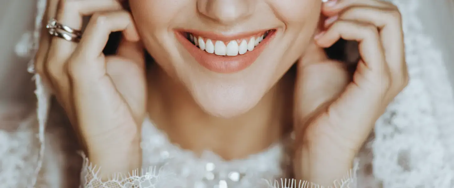 Affordable Cosmetic Dentistry for Weddings in Phoenix