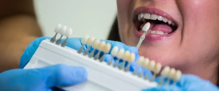 Dental Implants for Smokers