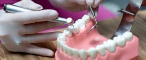 How Much Do Full Mouth Dental Implants Cost in Phoenix, AZ?