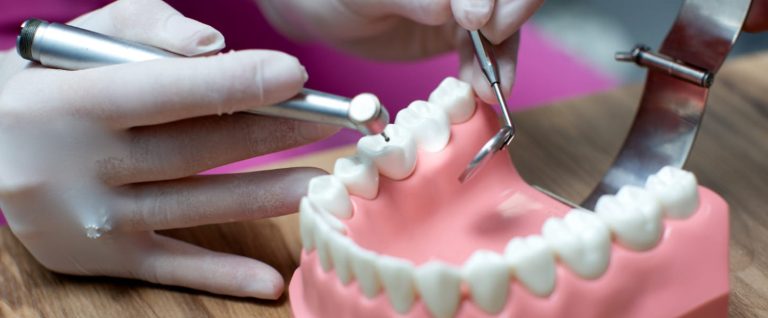 How Much Do Full Mouth Dental Implants Cost in Phoenix, AZ?